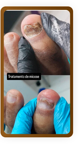 depoimento_07_1_1x