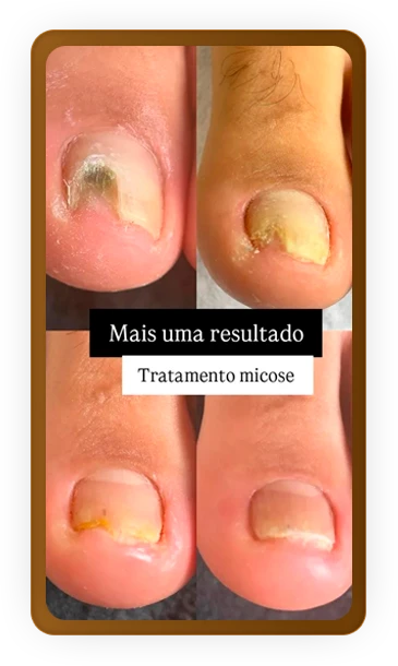 depoimento_10_1_1x