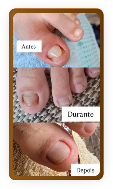 depoimento_11_1_1x